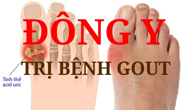 đông y trị bệnh gout