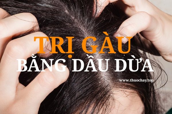 Trị gàu bằng dầu dừa